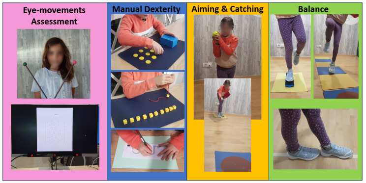 Relationship Between Ocular Motility and Motor Skills.