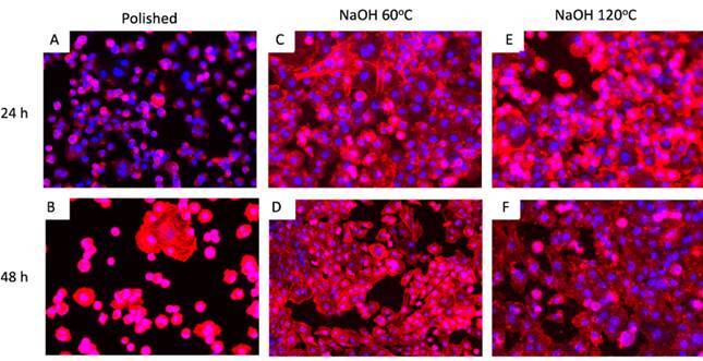 Effect Of Different Alkaline Treatments of Titanium Surface on Human Osteoblasts Metabolism.
