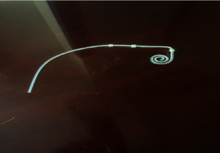 Peritoneal Dialysis of Three-Cuff Catheter Experience in Qassim Province, Saudi Arabia.