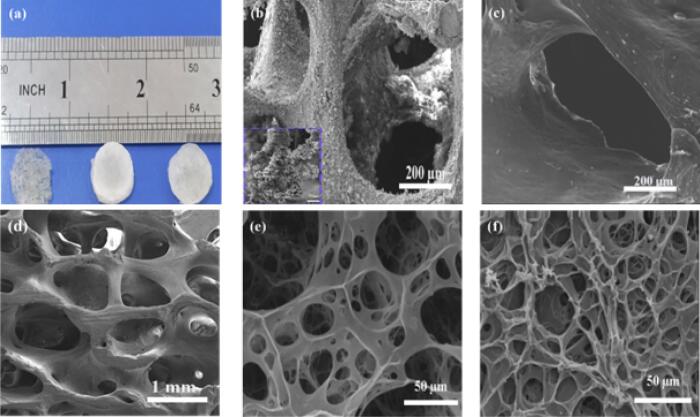 Chondrogenic potential of PMSCs cultured on chondroitin sulfate/gelatin-modified DBM scaffold.