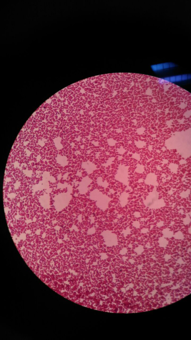 Antibacterial and antioxidant properties of sumac extract on methicillin-resistant Staphylococcus aureus.