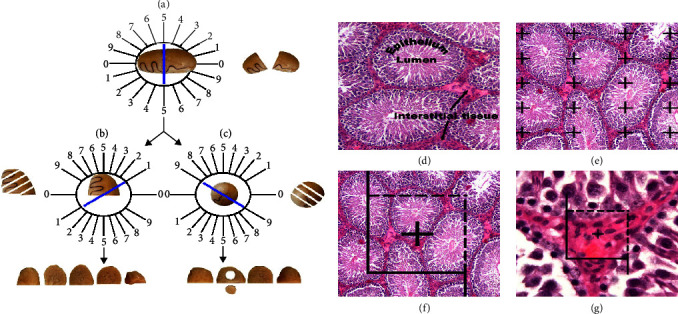 Wharton's Jelly Mesenchymal Stem Cell Conditioned Medium Ameliorates Diabetes-Induced Testicular Damage and Sperm Abnormalities by Mitigating Oxidative Stress, Apoptosis, and Inflammation.