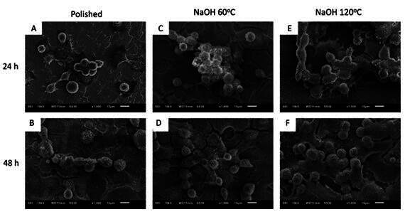 Effect Of Different Alkaline Treatments of Titanium Surface on Human Osteoblasts Metabolism.