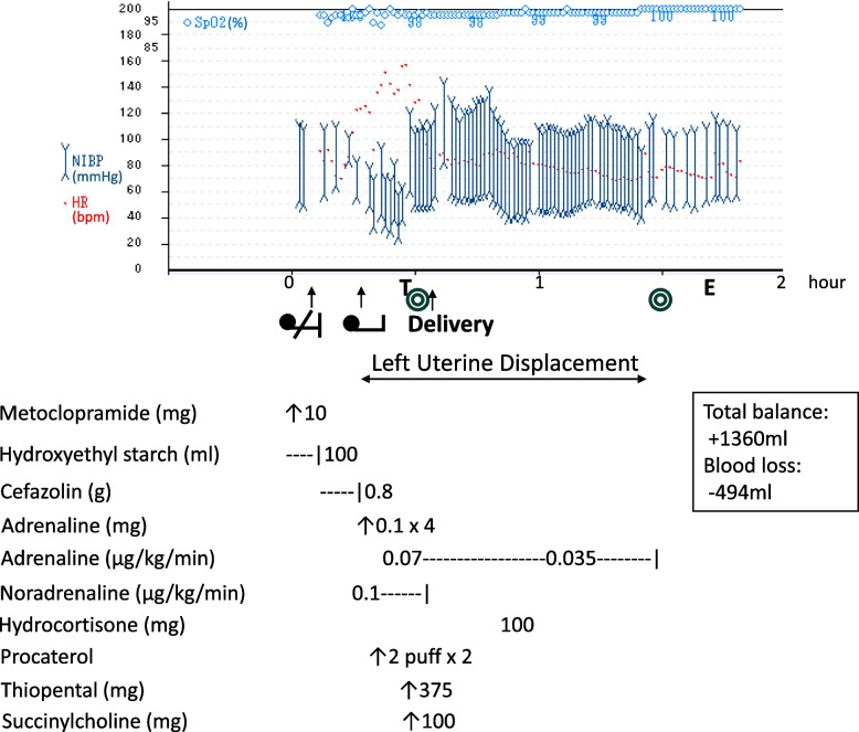 Successful management of anaphylactic shock prior to elective cesarean delivery: a case report.