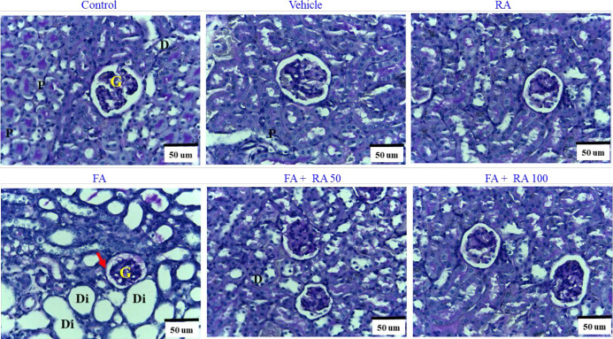 SIRT1/NOX1 pathway mediated ameliorative effects of rosmarinic acid in folic acid-induced renal injury.