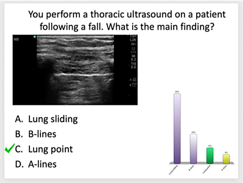 Lessons Learned from Integrating Educational Technology into the Preclerkship Teaching of Pulmonary Medicine.