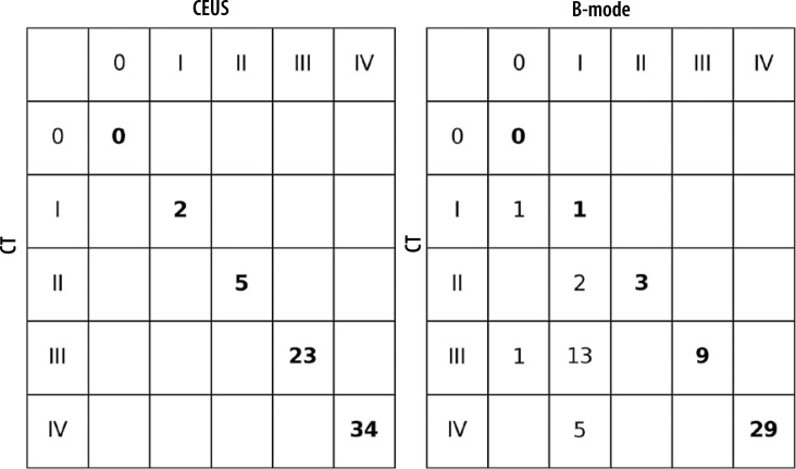 Comparative efficacy of contrast-enhanced ultrasound versus B-mode ultrasound in the diagnosis and monitoring of hepatic abscesses.