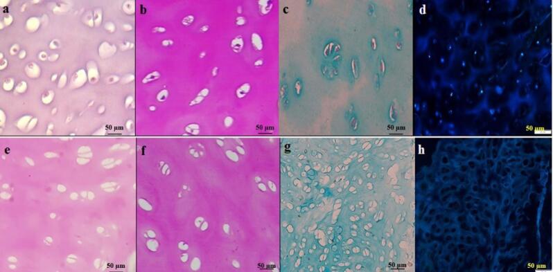 An update on technical method of cartilage decellularization: A physical-based protocol.