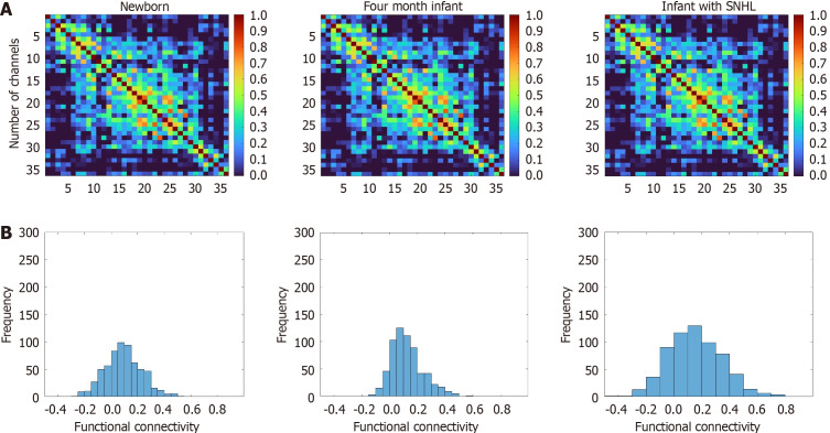 Brain networks in newborns and infants with and without sensorineural hearing loss: A functional near-infrared spectroscopy study.