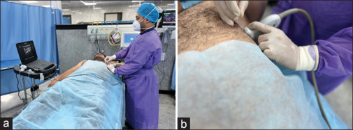 Assessing the Clinical Impact of Emergency Physician-performed Ultrasound-guided Peripheral Nerve Blocks in a Level 1 Trauma Center: A Retrospective Analysis.
