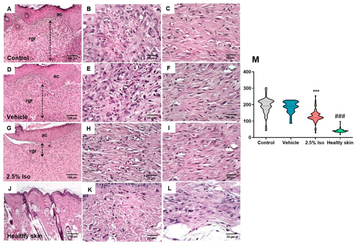 Isoorientin Improves Excisional Skin Wound Healing in Mice.