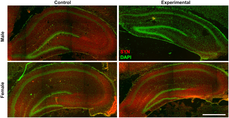 A maternal low-protein diet results in sex-specific differences in synaptophysin expression and milk fatty acid profiles in neonatal rats.