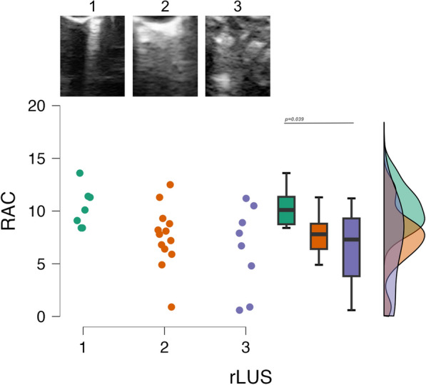 Quantitative lung ultrasound findings correlate with radial alveolar count in experimental bronchopulmonary dysplasia.