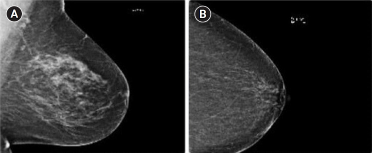 BCED-Net: Breast Cancer Ensemble Diagnosis Network using transfer learning and the XGBoost classifier with mammography images.
