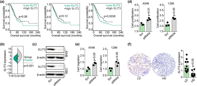 SLIT3 deficiency promotes non-small cell lung cancer progression by modulating UBE2C/WNT signaling.