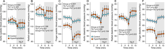 Haemodynamics of hyperthyroidism: increased cardiac work and findings related to vasodilatation.