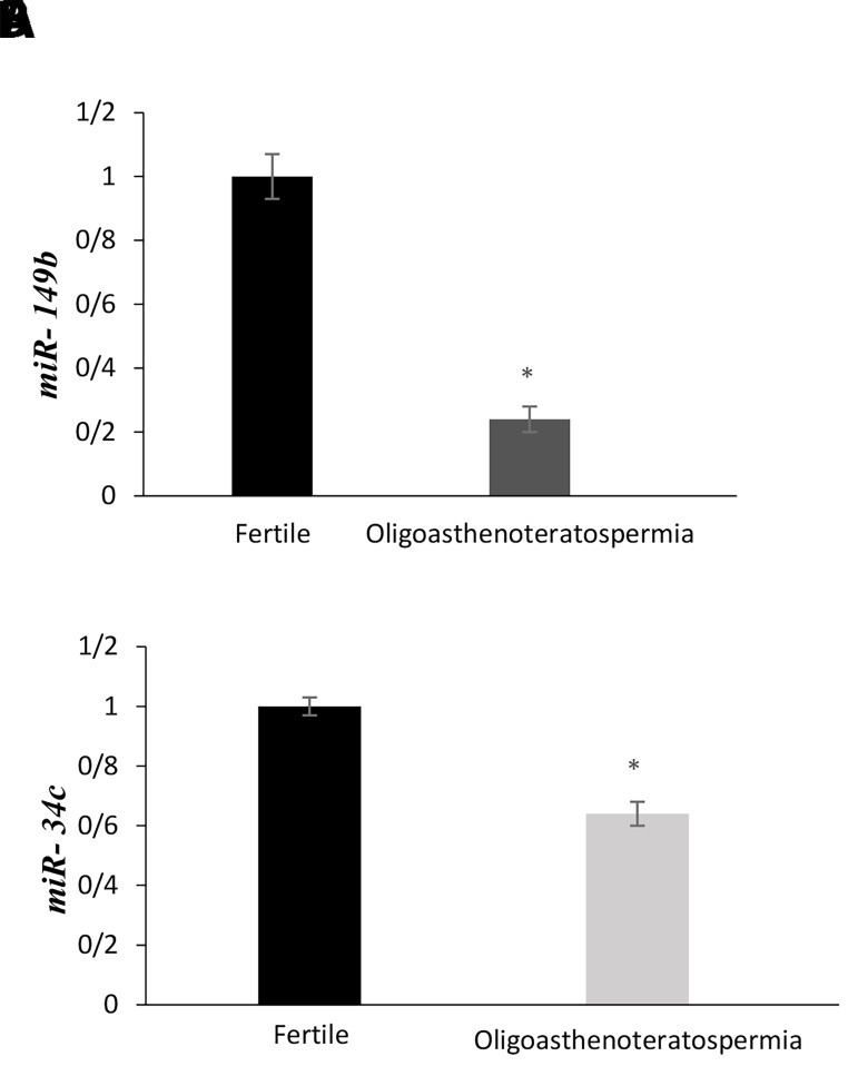 The Relationship between The Expression of Sperm <i>MicroRNA-149b</i> and <i>34c</i> and Sperm Quality in Men with Oligoasthenoteratozoospermia in Endometriosis.