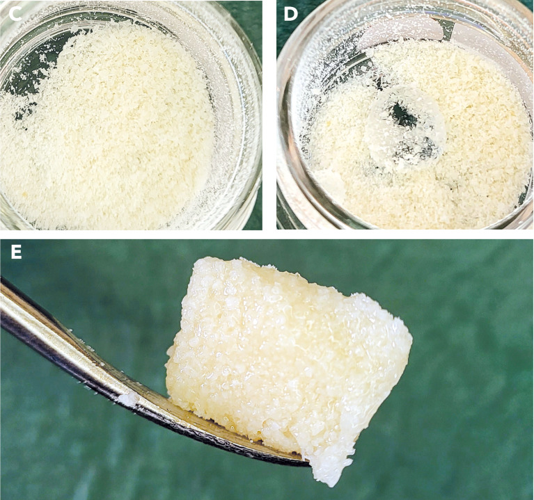 Enhanced alveolar ridge preservation with hyaluronic acid-enriched allografts: a comparative study of granular allografts with and without hyaluronic acid addition.
