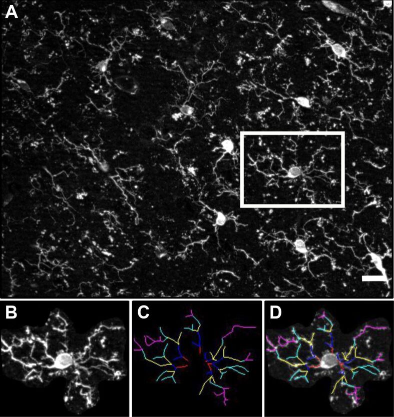 Acute liver damage generates age independent microglia morphology changes in mice.