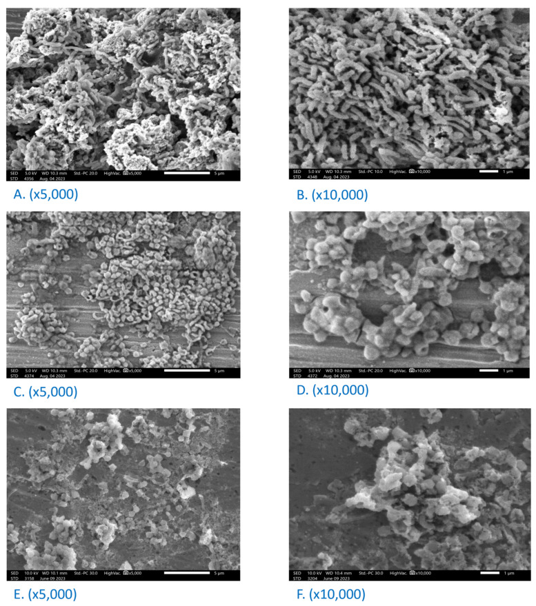 Phytochemical Composition, Antioxidant, Anti-<i>Helicobacter pylori</i>, and Enzyme Inhibitory Evaluations of <i>Cleistocalyx operculatus</i> Flower Bud and Leaf Fractions.