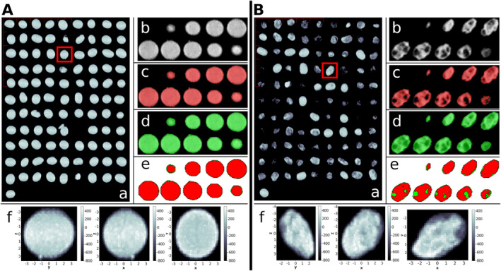 Detection of damage caused by <i>Nezara viridula</i> on soybean using novel imaging approaches based on computed tomography and image color analysis.