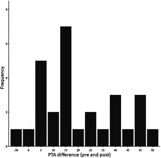 Results of a New Treatment Protocol for Sudden Sensorineural Hearing Loss Using Betamethasone for Intratympanic Therapy.