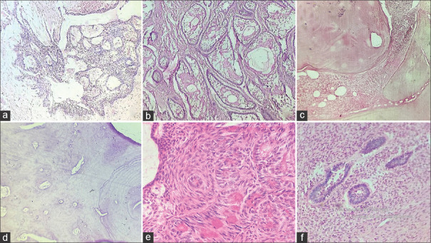 A comprehensive analysis of odontogenic tumors according to recent WHO (2022) classification: An institution-based retrospective study.