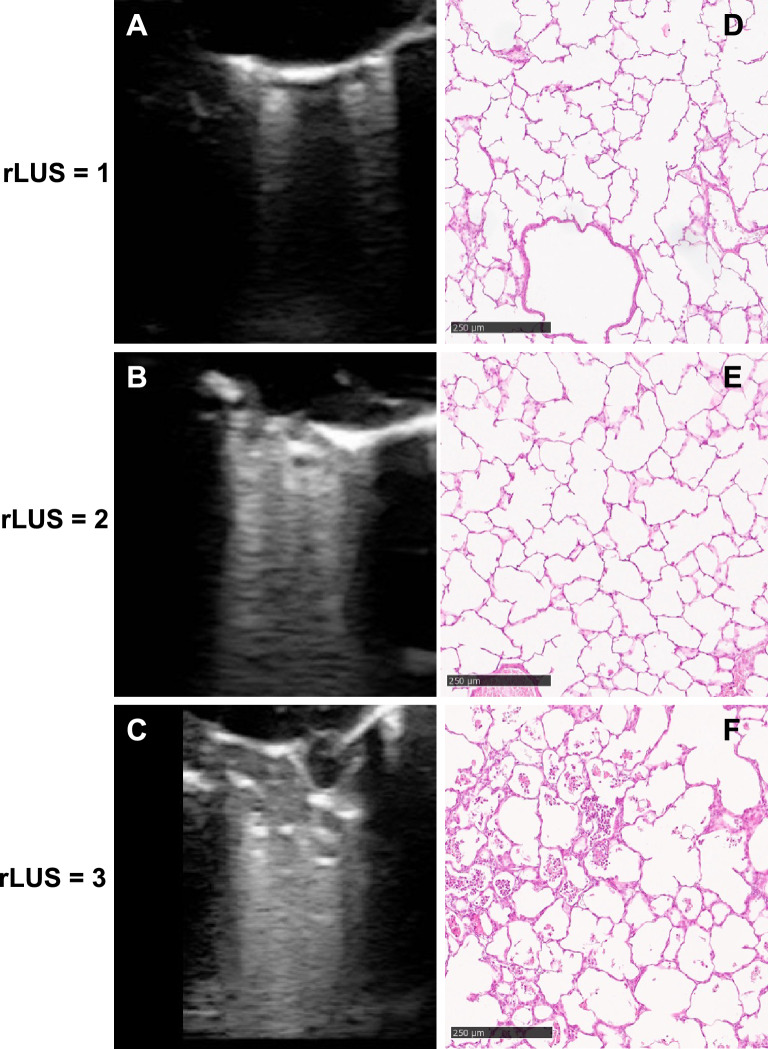 Quantitative lung ultrasound findings correlate with radial alveolar count in experimental bronchopulmonary dysplasia.