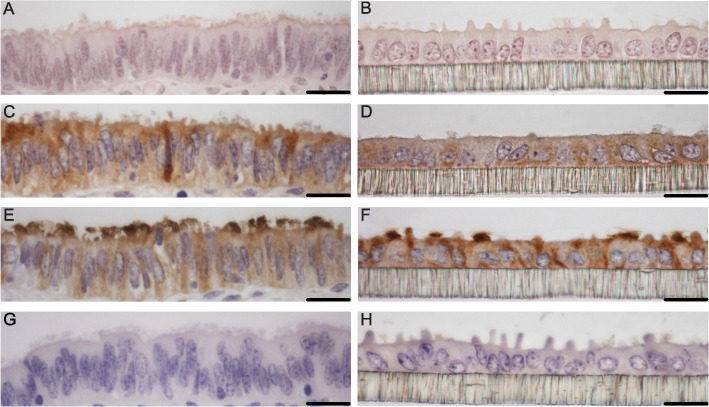 Maternal stress and the early embryonic microenvironment: investigating long-term cortisol effects on bovine oviductal epithelial cells using air-liquid interface culture.