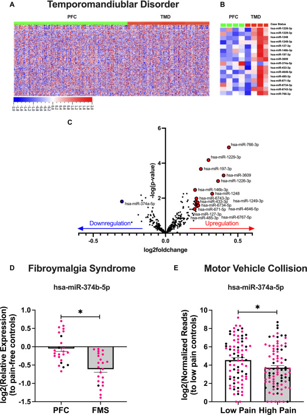 miR-374 family is a key regulator of chronic primary pain onset.