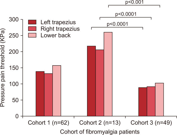 Pressure pain threshold encode hyperalgesia or antinociception in fibromyalgia patients?