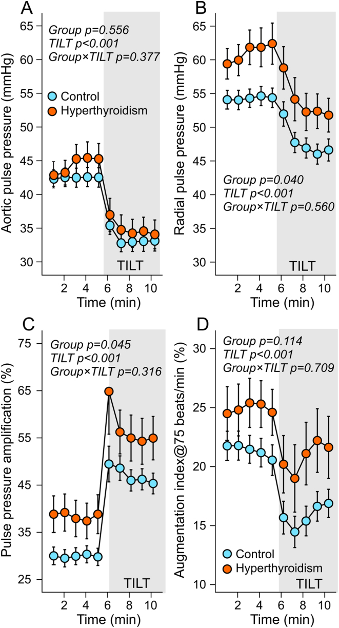 Haemodynamics of hyperthyroidism: increased cardiac work and findings related to vasodilatation.