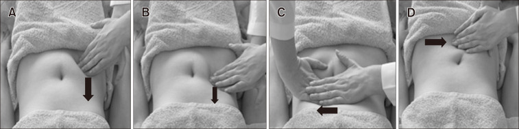 Effectiveness of Abdominal Massage Versus Kinesio Taping in Women With Chronic Constipation: A Randomized Controlled Trial.