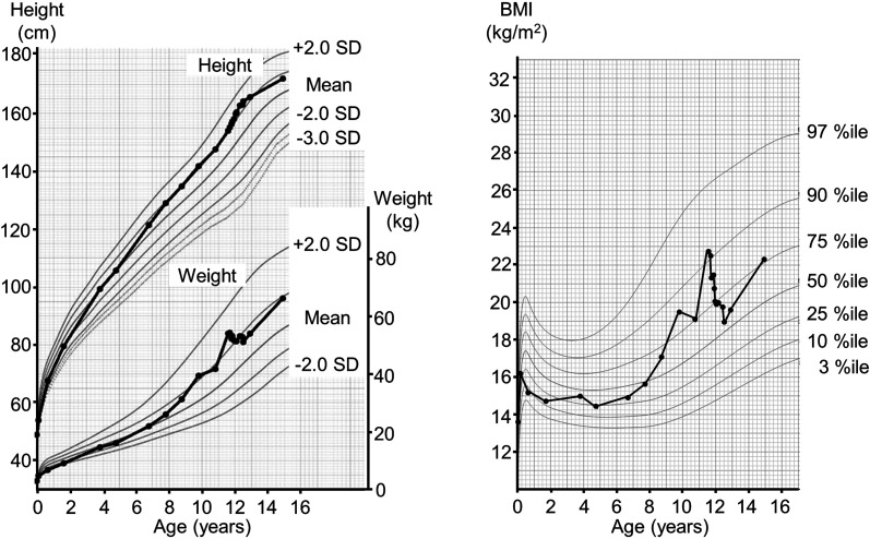 Initial clinical manifestations in a young male with <i>RFX6</i>-variant-associated diabetes.