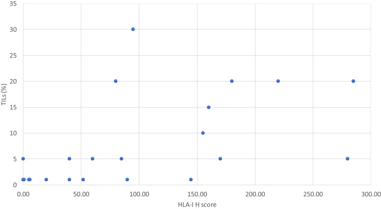 Human Leukocyte Antigen Class I Expression and Natural Killer Cell Infiltration and Its Correlation with Prognostic Features in Luminal Breast Cancers.
