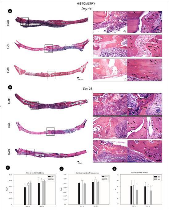 Effect of local and systemic administration of atorvastatin for improving bone healing on critical defects.