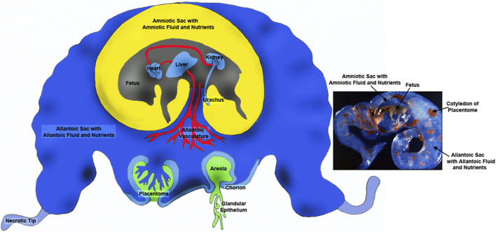Fructose metabolism is unregulated in cancers and placentae.