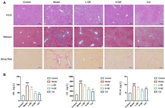 Quercetin alleviates liver fibrosis via regulating glycolysis of liver sinusoidal endothelial cells and neutrophil infiltration.