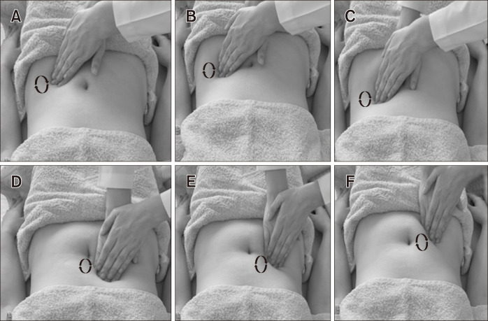 Effectiveness of Abdominal Massage Versus Kinesio Taping in Women With Chronic Constipation: A Randomized Controlled Trial.