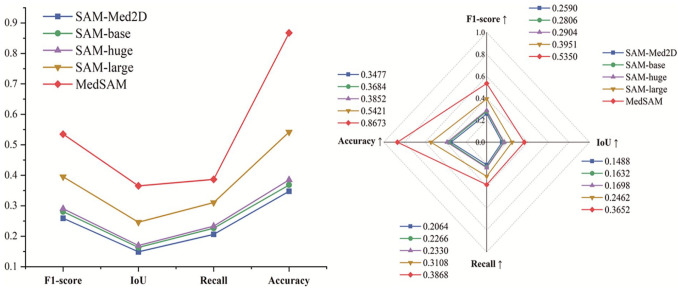 Deep Learning-Based Detection of Impacted Teeth on Panoramic Radiographs.