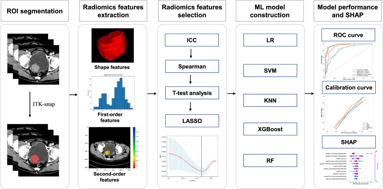 A radiomics-based interpretable machine learning model to predict the HER2 status in bladder cancer: a multicenter study.