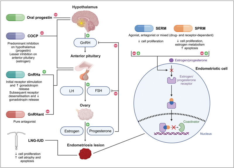 Medical management of endometriosis.