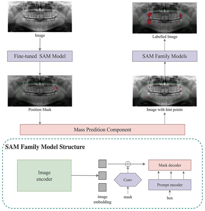 Deep Learning-Based Detection of Impacted Teeth on Panoramic Radiographs.