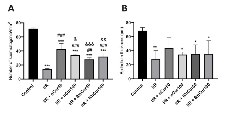 Nanocurcumin Decreases Nucleotide-Binding Oligomerization Domain-Like Receptor Family Pyrin Domain-Containing 3 Complex Expressions in An Experimental Testicular Torsion Model.