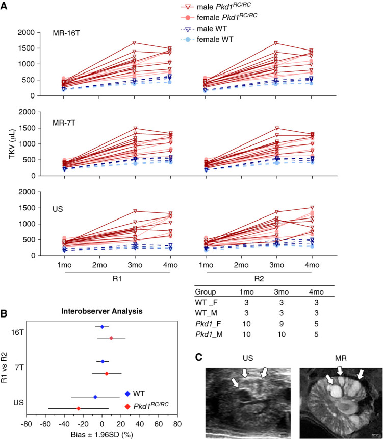 Robotic Ultrasound and Novel Collagen Analyses for Polycystic Kidney Disease Research Using Mice.