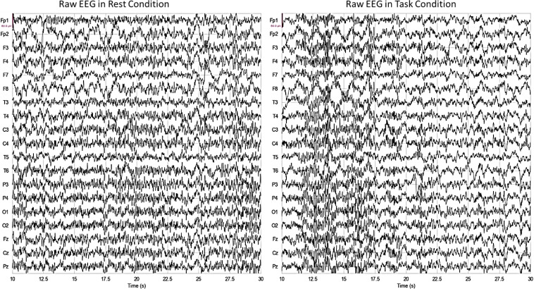 Exploring Brain Activity in Different Mental Cognitive Workloads.