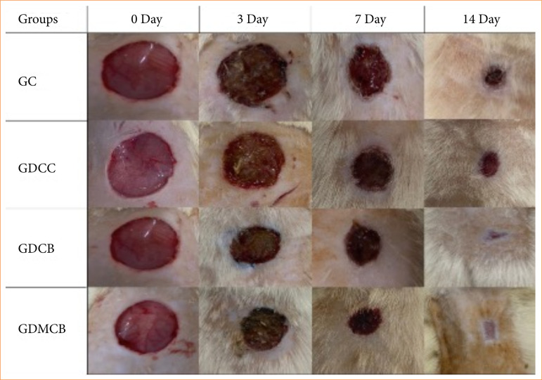 Melatonin associated with bacterial cellulose-based hydrogel improves healing of skin wounds in diabetic rats.