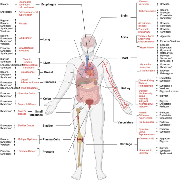 Soluble Proteoglycans and Proteoglycan Fragments as Biomarkers of Pathological Extracellular Matrix Remodeling.