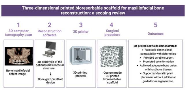 Three-dimensional printed bioresorbable scaffold for maxillofacial bone reconstruction: A Scoping Review.