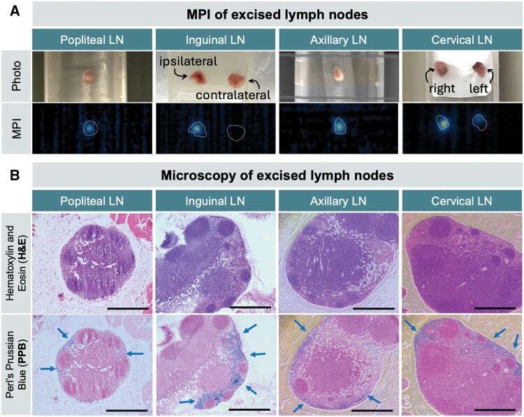 Magnetic particle imaging enables nonradioactive quantitative sentinel lymph node identification: feasibility proof in murine models.
